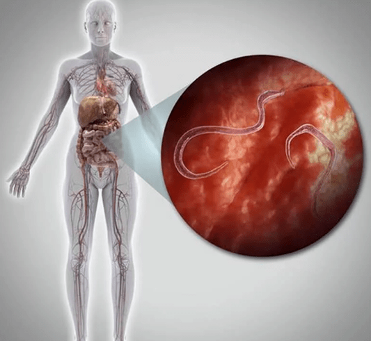 Paraziți în corpul uman