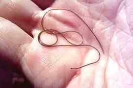 Parazit în palma mâinii tale