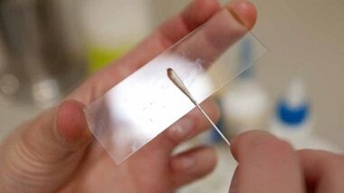 Analiza Calais pentru identificarea paraziților