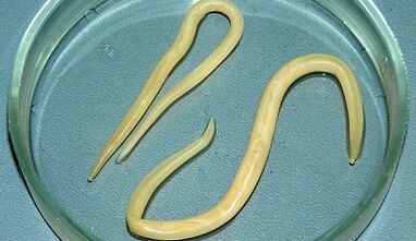 Cum să efectuați corect testele pentru ascariază