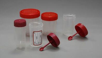 Cum să vă pregătiți pentru testul paraziților