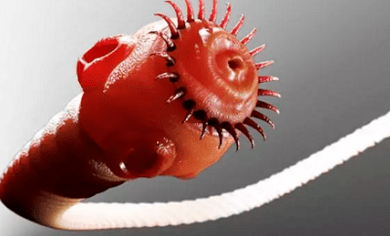 Ce paraziți pot trăi în corpul uman