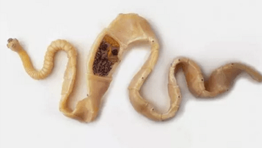 Cum să descoperi prezența paraziților în corp