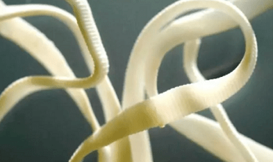 Cum să îndepărtați paraziții din corpul uman